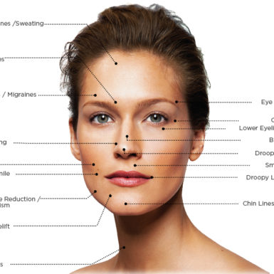 Botox possible Treatment Areas