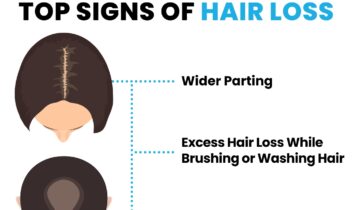signs of hair loss