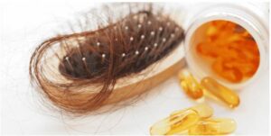 hair growth supplements
