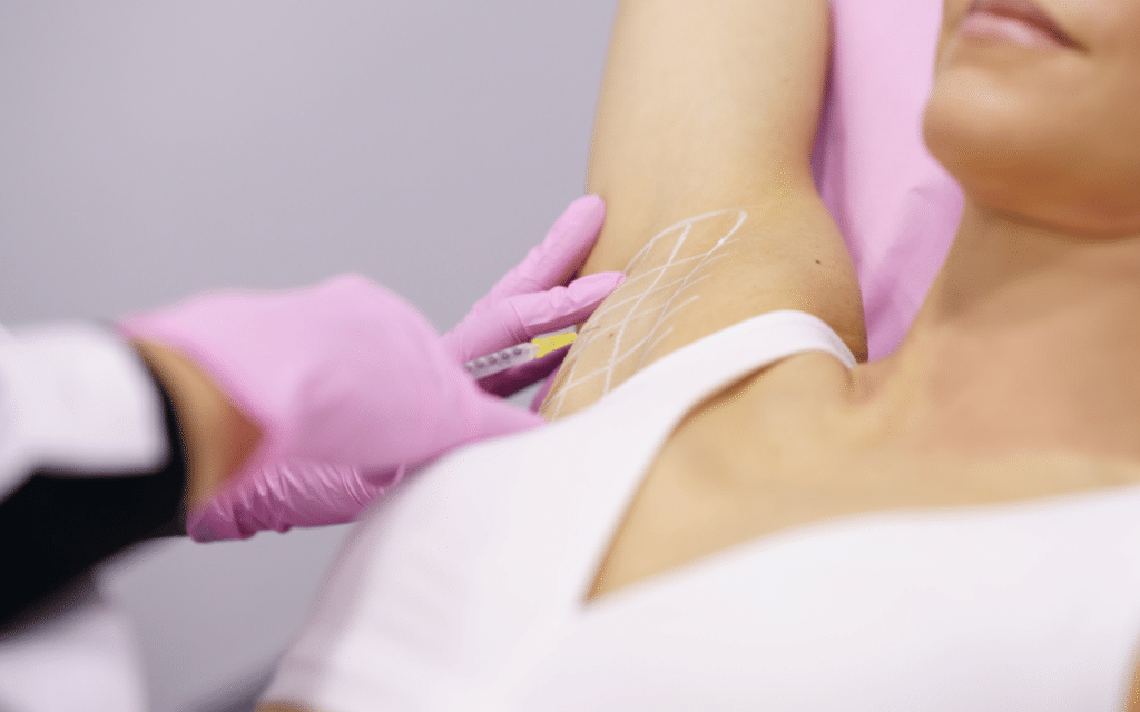 botox for excessive sweating