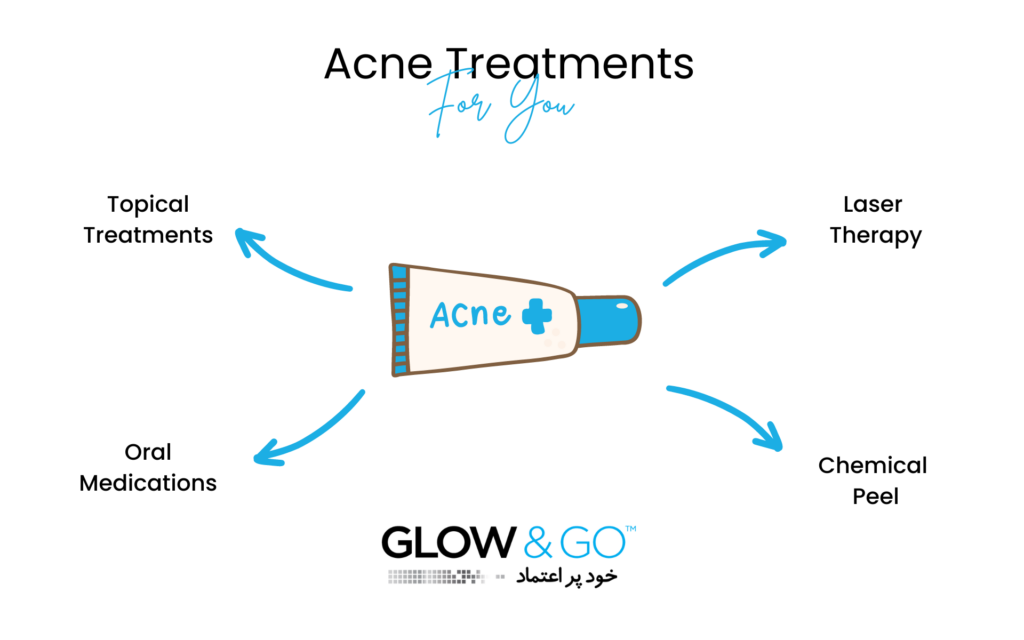 acne treatment plan